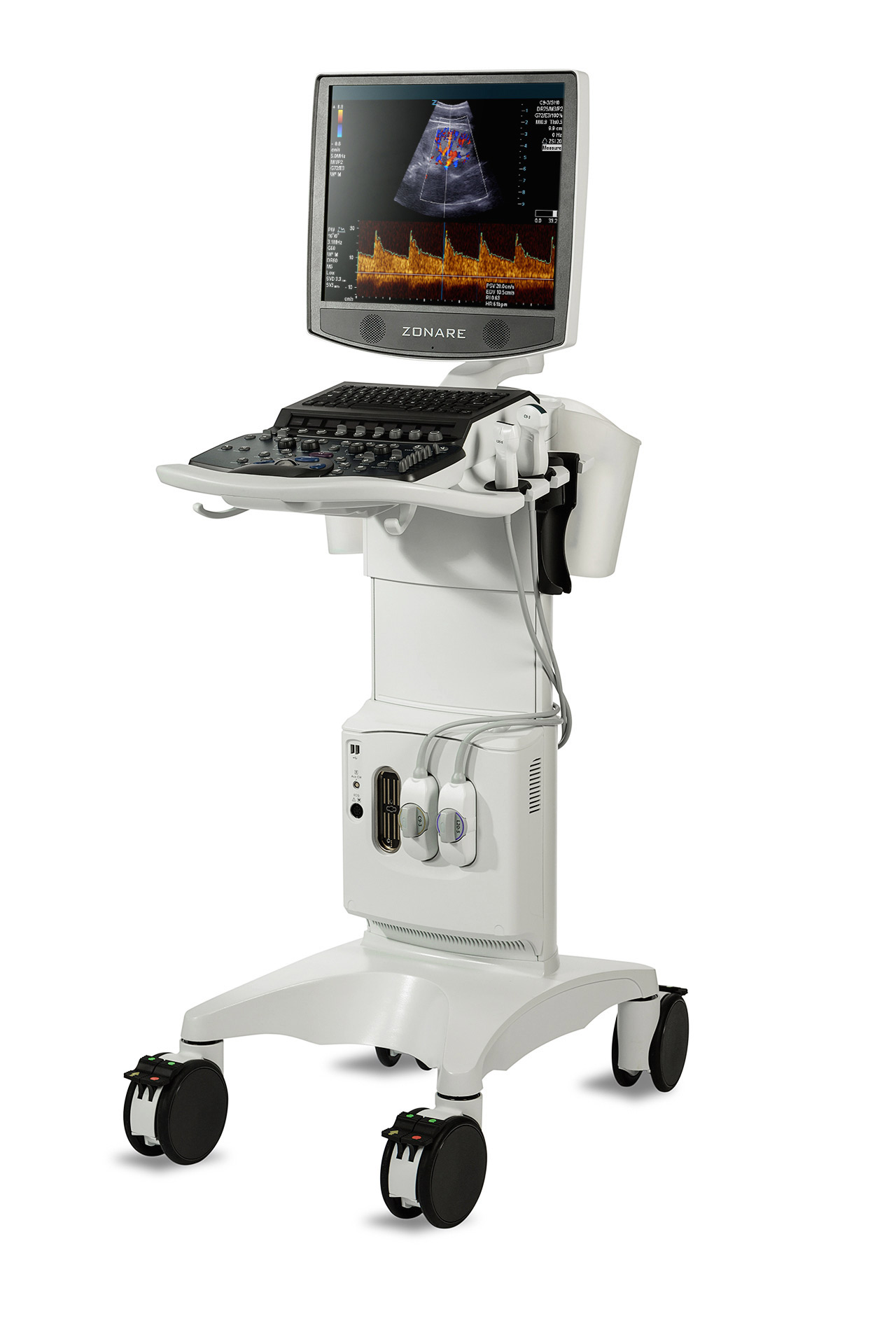 ZS3 Ultrasound System Diamond Edition - ZONE Sonography® Technology+ (ZST+)